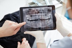 Close,Up,Woman,Dentist,Holding,Patient,Mouth,Digital,Film.female,Doctor